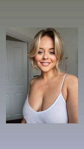 Emily Atack Nude Leaks OnlyFans Photo 134