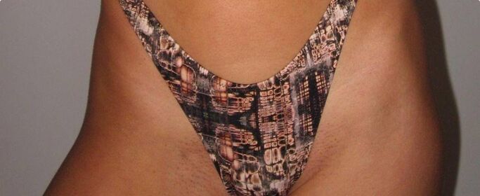 Emily Feld Nude Leaks OnlyFans Photo 1108