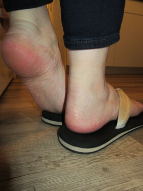 Neolasoles Uniknutá nahá OnlyFans fotografia 45