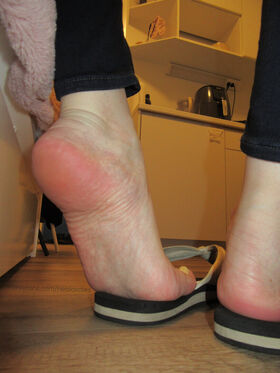 Neolasoles Uniknutá nahá OnlyFans fotografia 46