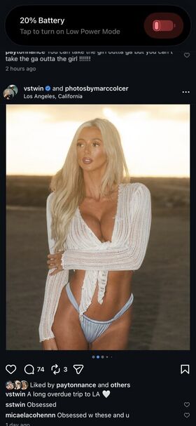 Vstwin Ảnh OnlyFans khỏa thân rò rỉ 27